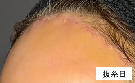 02 傷痕も目立たない