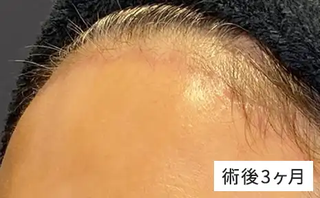 02 傷痕も目立たない