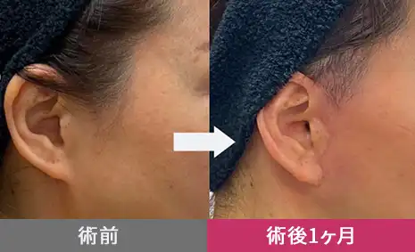 02 傷痕も目立たない