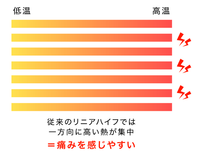 ポイントは往復照射による熱(痛み)の分散