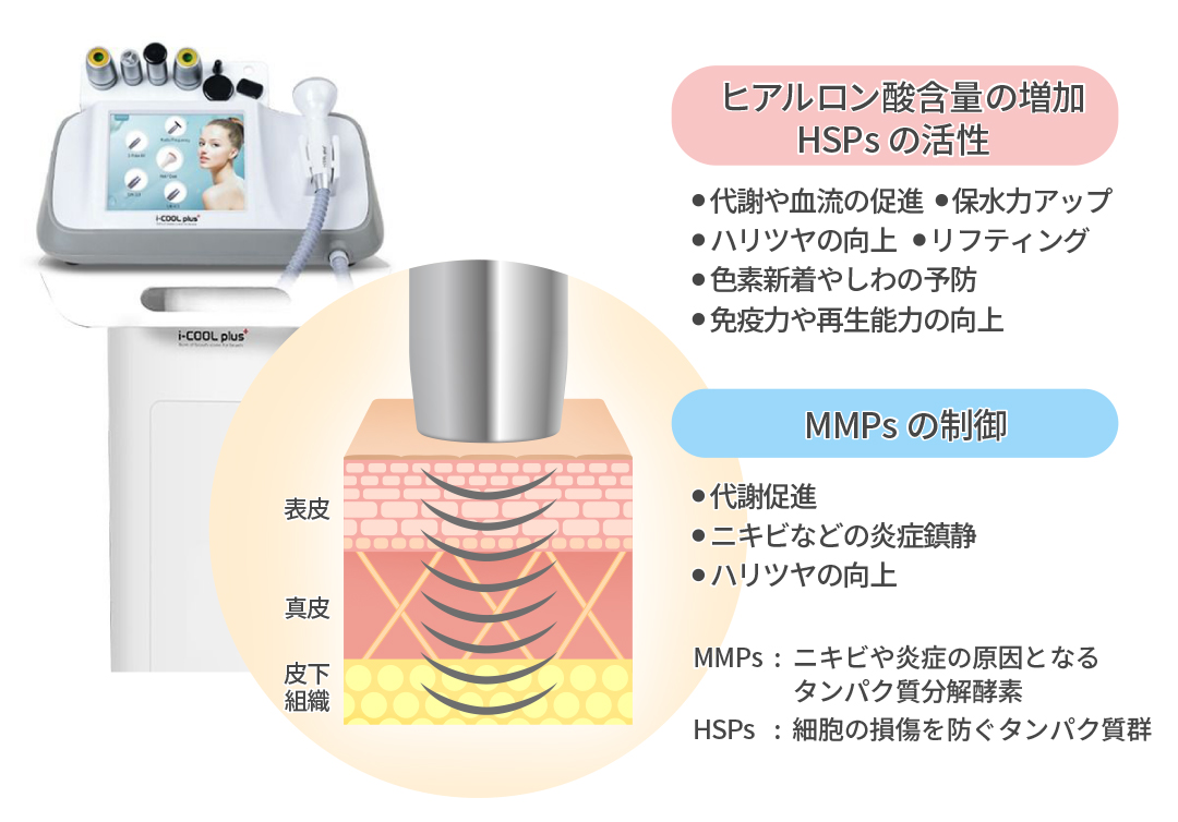 LDM(水玉リフティングとは)