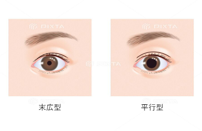 01 様々なデザインでの対応が可能
