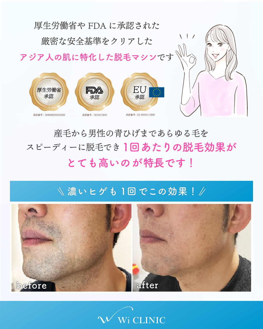 医療脱毛トライアルキャンペーン