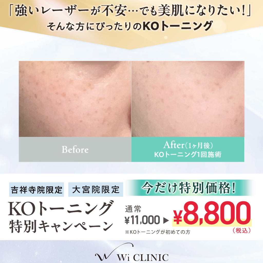 KOトーニング 特価チャンス 新型トーニング体験✨