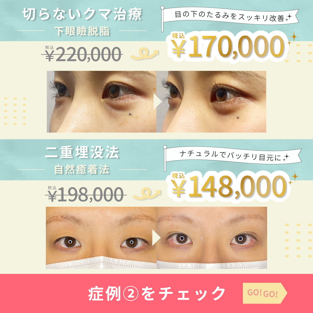 【Go! Go!外科キャンペーン】GW限定外科術5万円OFF✨