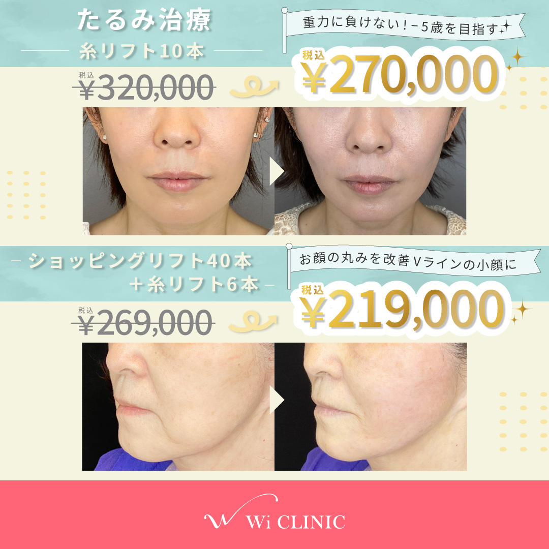 【Go! Go!外科キャンペーン】GW限定外科術5万円OFF✨