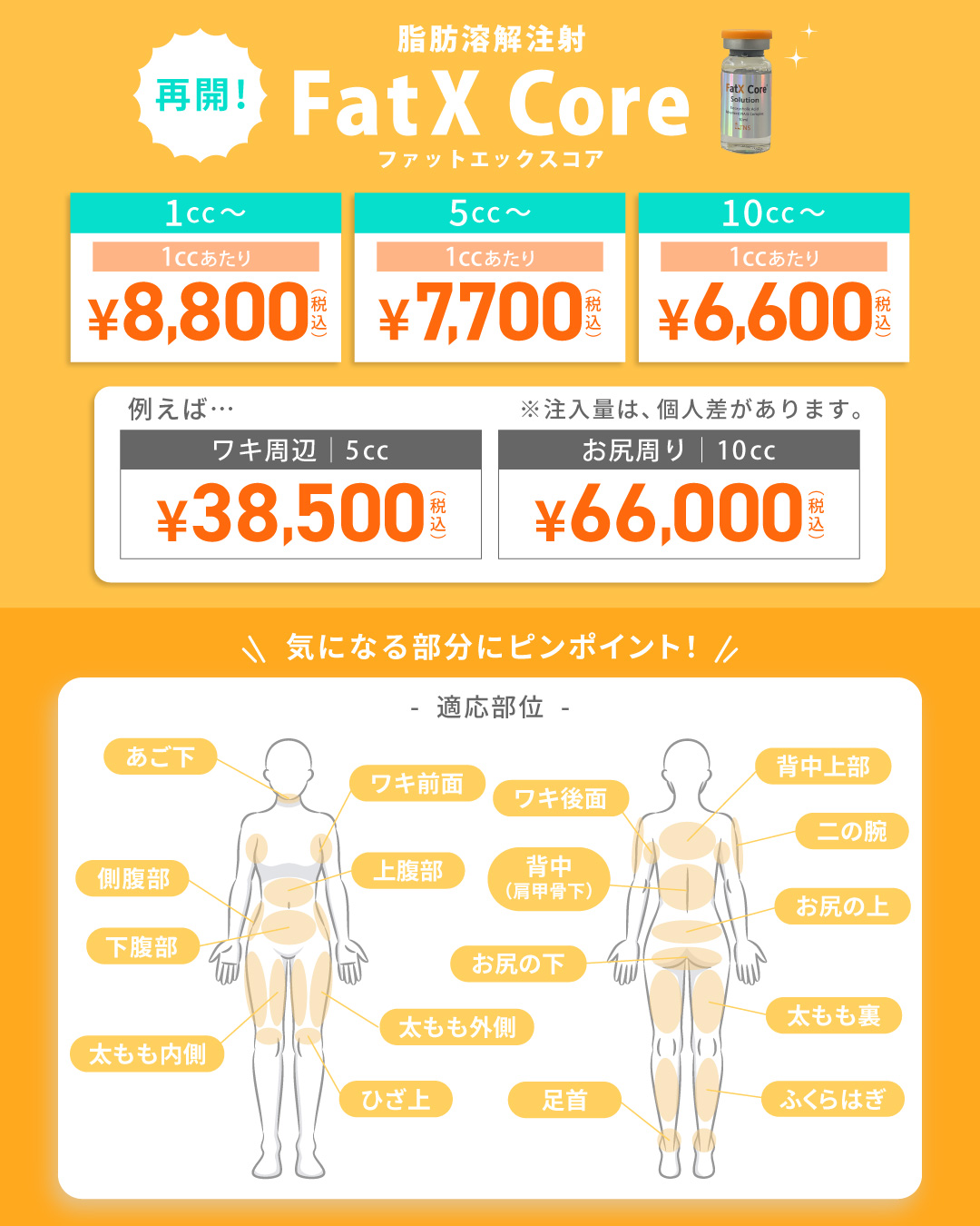 【2026】第4世代脂肪溶解注射[FatX Core]ファットエックスコア